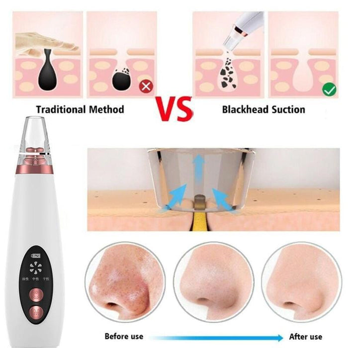 USB Rechargeable Blackhead Remover Face Pore Vacuum Skin Care Acne Pore Cleaner Pimple Removal Vacuum Suction Facial Tools